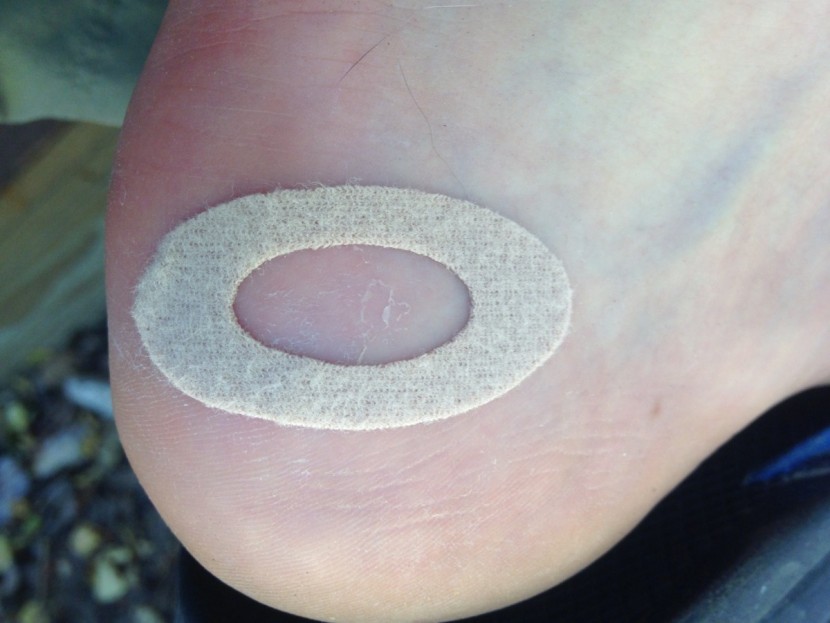 adventure medical kits ultralight/watertight .7 - a full sheet of moleskin donuts for blister relief was good to see...