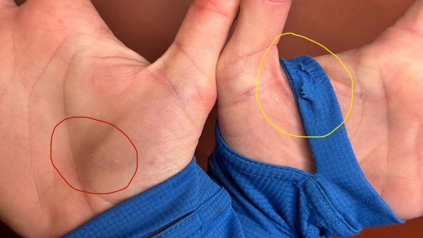 outdoor research echo hoodie for women - after an epic fall while running, the tear in the cuff (circled in...